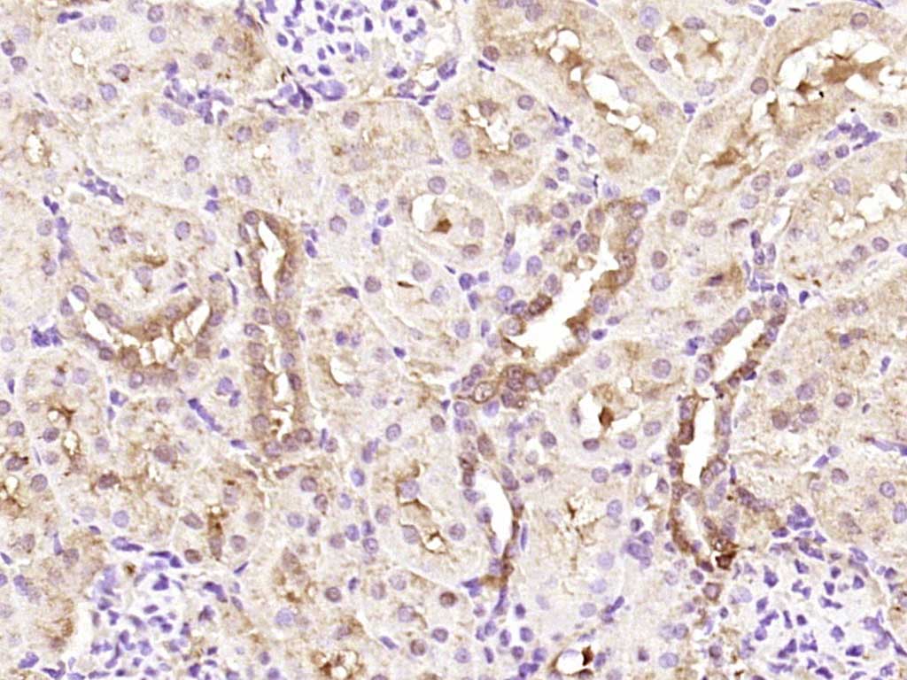 EDC4 Rabbit pAb(bs-10953R)-50u