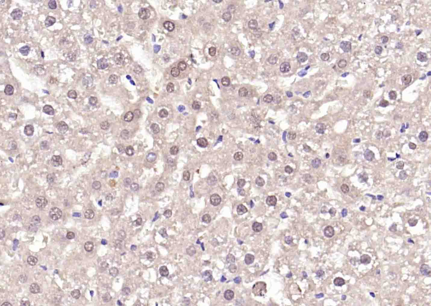LKB1 Rabbit pAb(bs-3948R)-50ul
