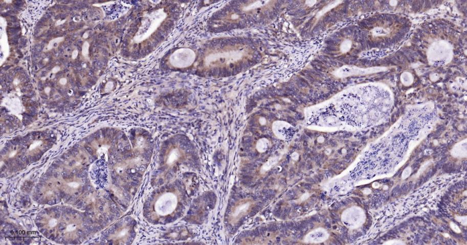 SIRT3 Rabbit pAb(bs-6105R)-50u