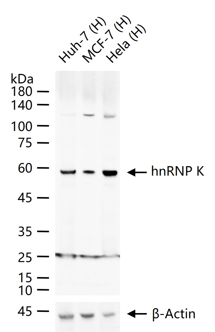 hnRNP K Rabbit pAb(bs-4296R)-5