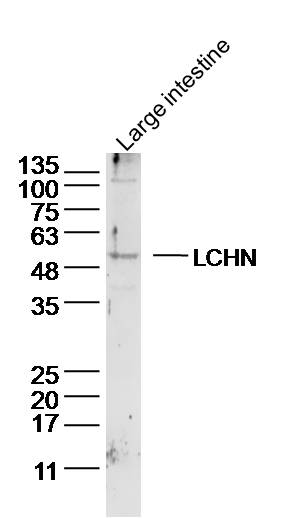 LCHN Rabbit pAb(bs-18187R)-50u