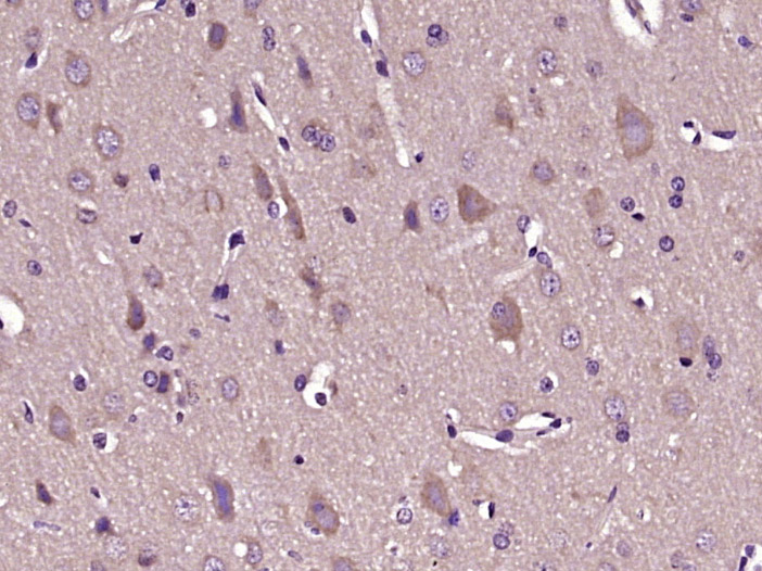 HCFC1R1 Rabbit pAb(bs-17359R)-