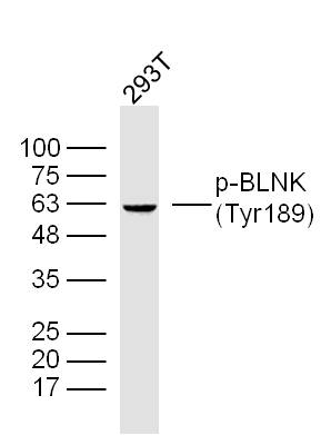 phospho-BLNK (Tyr189) Rabbit p