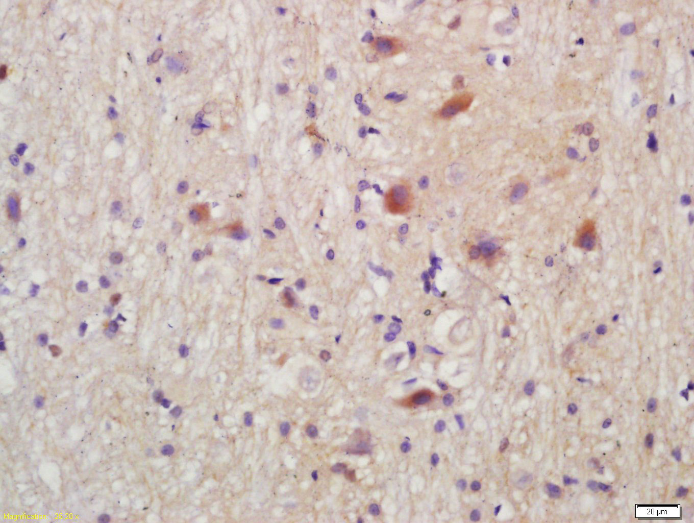 TORC2 Rabbit pAb(bs-3590R)-50u