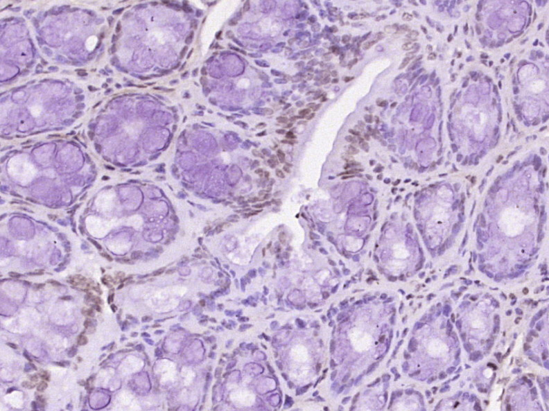 phospho-BTK (Tyr223) Rabbit pA