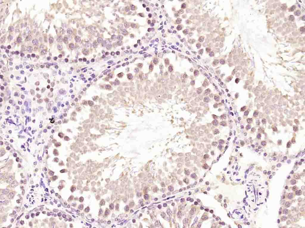 FAR2 Rabbit pAb(bs-10256R)-50u