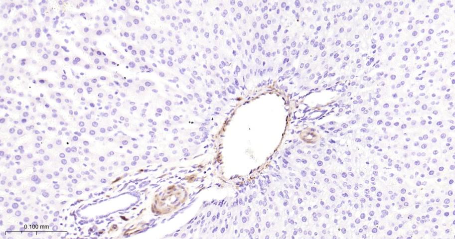 Hsp27 Recombinant Rabbit mAb(b