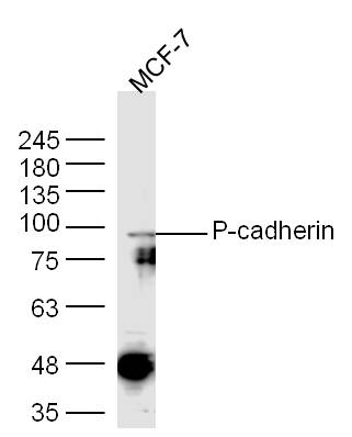 P-cadherin Rabbit pAb(bs-1159R