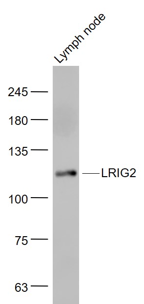 LRIG2 Rabbit pAb(bs-1845R)-50u
