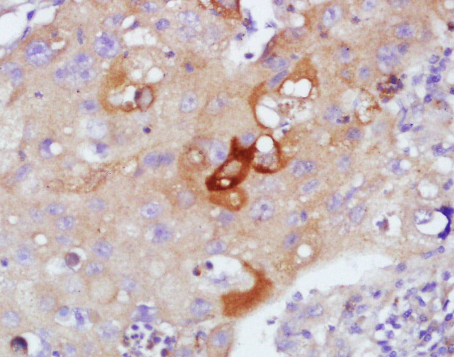 SFTPA1 Rabbit pAb(bs-0770R)-50