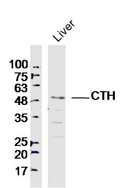 CTH Rabbit pAb(bs-9515R)-50ul/