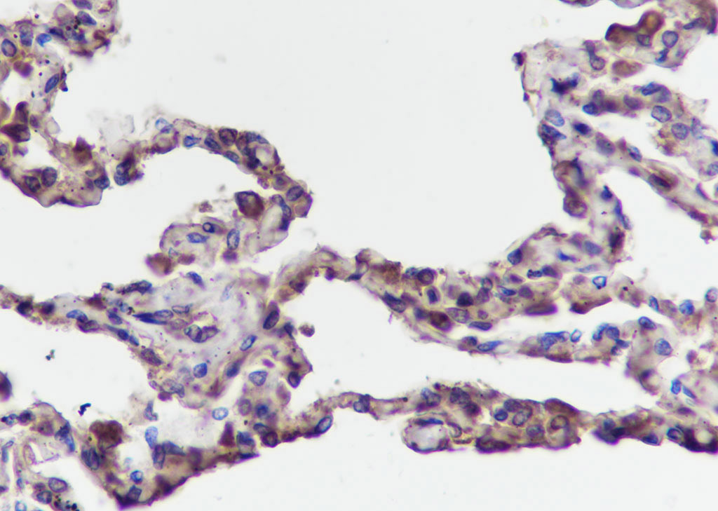 TMEM111 Recombinant Mouse mAb(