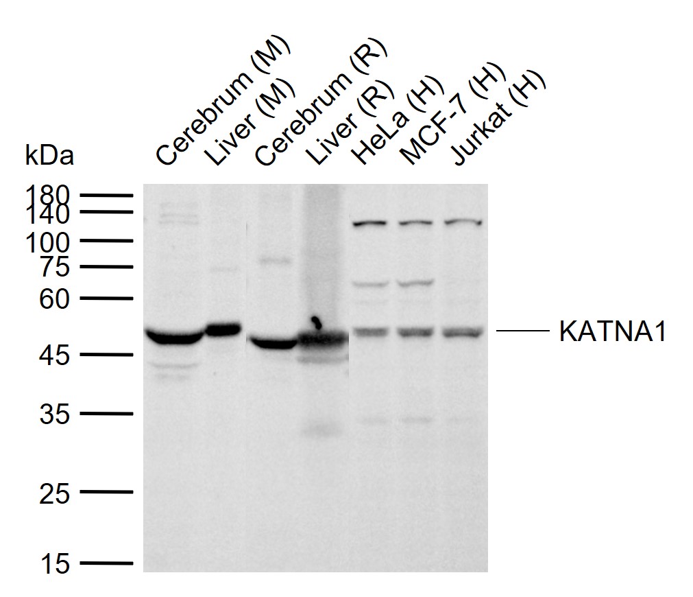 KATNA1 Rabbit pAb(bs-9308R)-50
