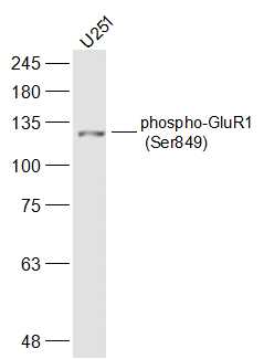 phospho-GluR1 (Ser849) Rabbit 