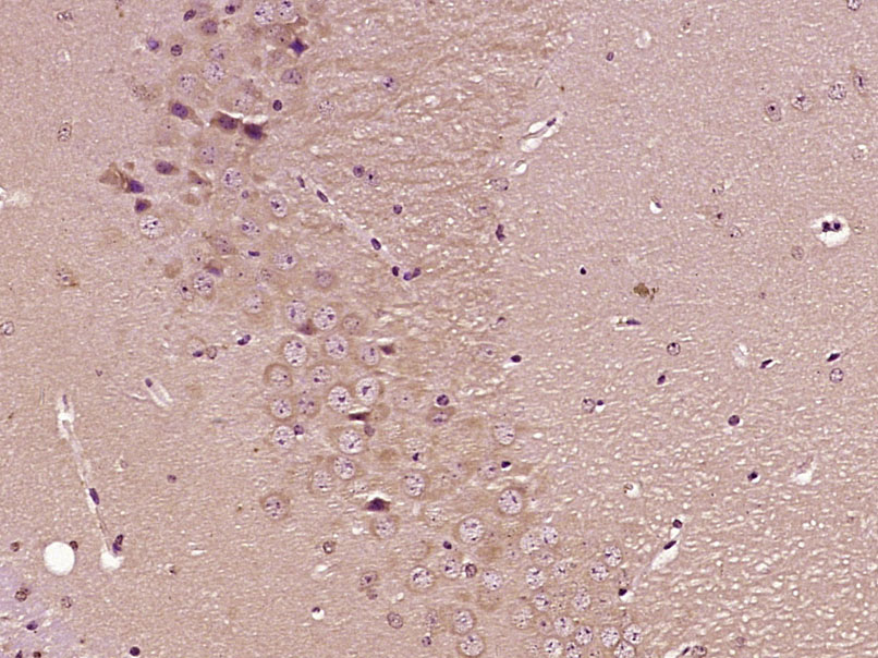 FSCN1 Rabbit pAb(bs-0796R)-50u