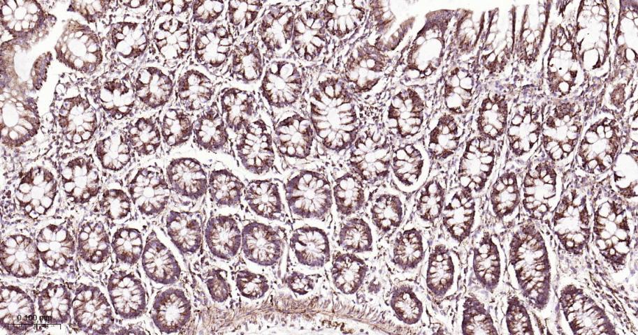 SDHB Recombinant Rabbit mAb(bs