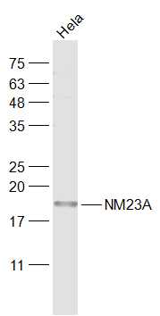 NME1/NM23A Rabbit pAb(bs-1066R