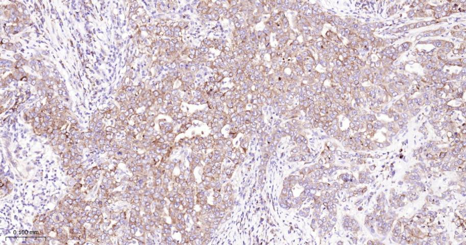 EIF2S1 Recombinant Rabbit mAb(