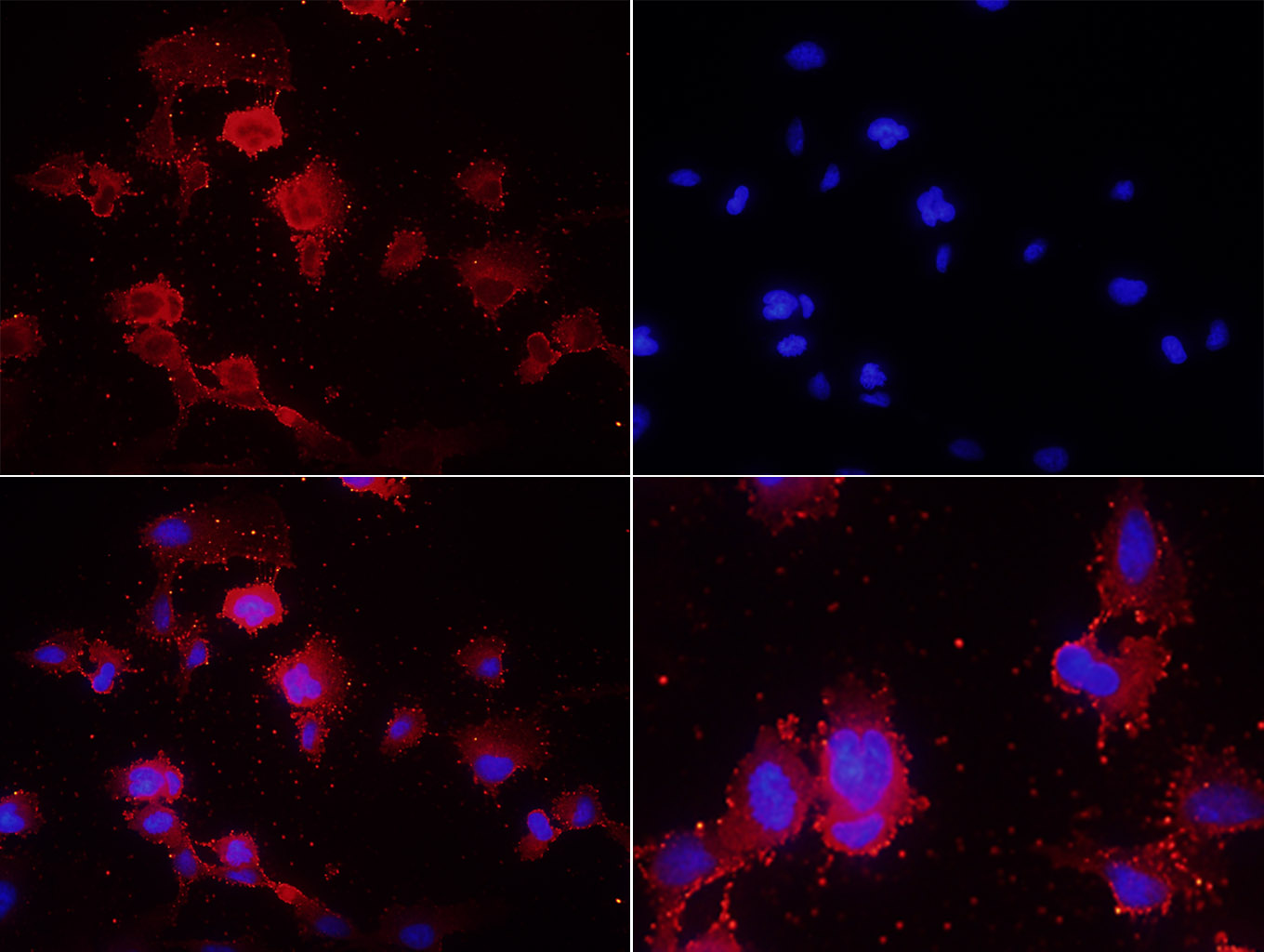 P-cadherin Rabbit pAb(bs-1159R