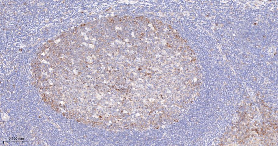 phospho-FoxO3a (Ser253) Recomb