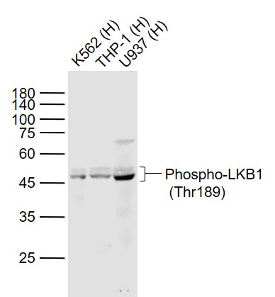 phospho-LKB1 (Thr189) Rabbit p