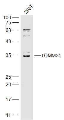 TOMM34 Rabbit pAb(bs-17226R)-5