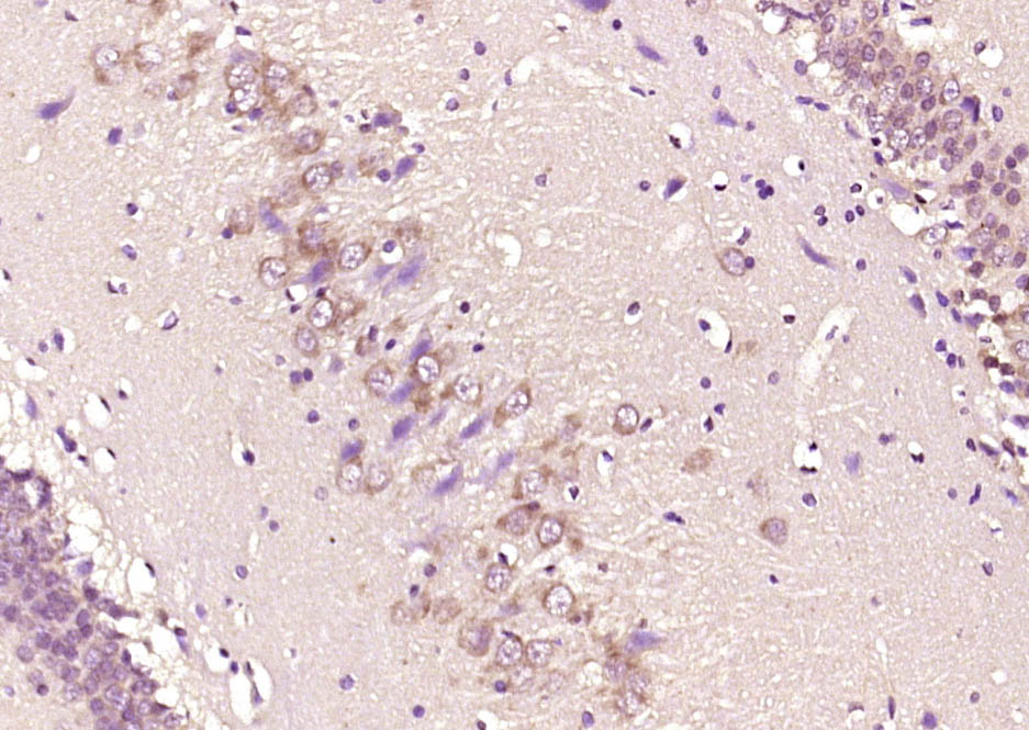 phospho-Smad3 (Ser425) Rabbit 