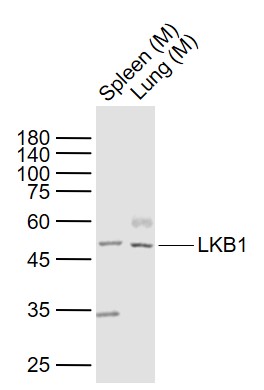 LKB1 Rabbit pAb(bs-3948R)-50ul