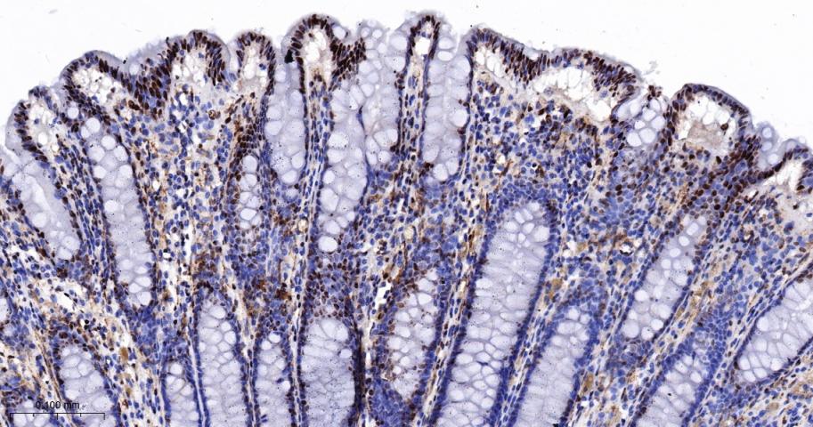 Ku80 Recombinant Rabbit mAb(bs