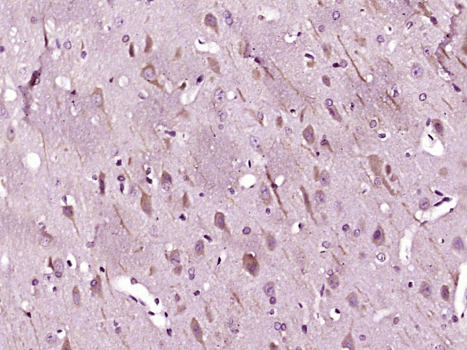 LC3B Rabbit pAb(bs-2912R)-50ul