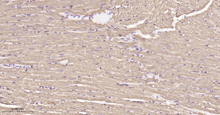 SDHB Recombinant Rabbit mAb(bs