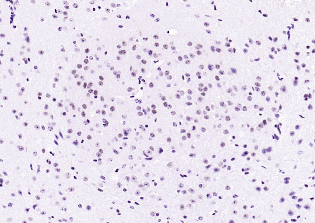 API5 Rabbit pAb(bs-1252R)-50ul