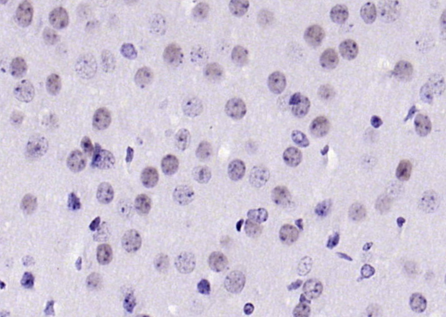 phospho-Bcl-xL (Thr115) Rabbit