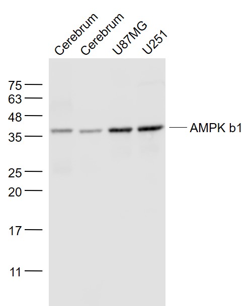 AMPK b1 Mouse mAb(bsm-33426M)-