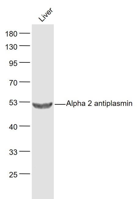 Alpha 2 antiplasmin Rabbit pAb