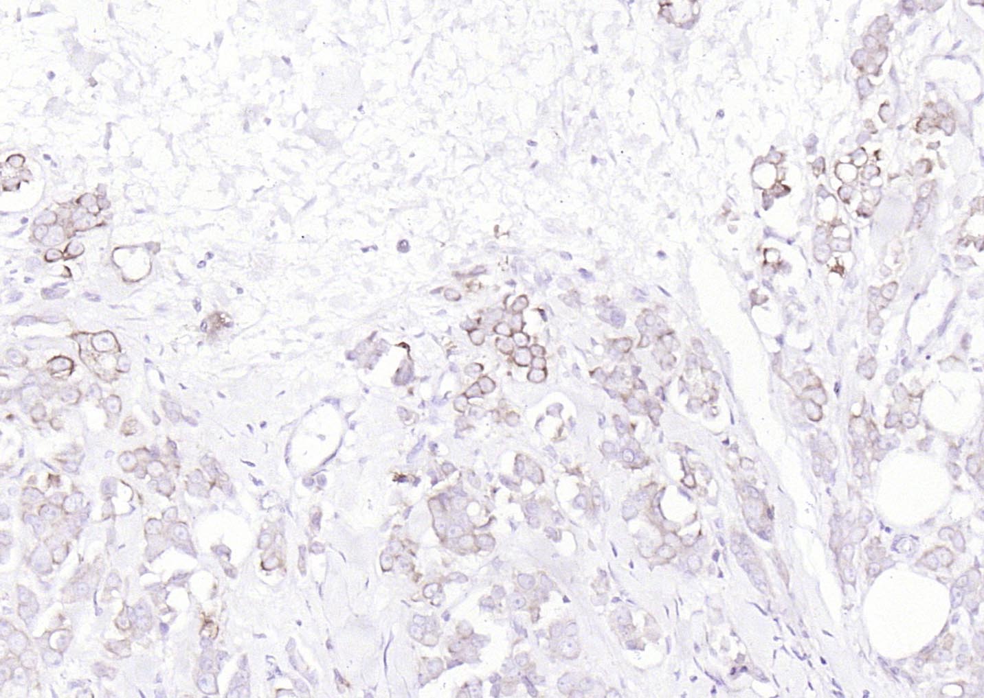 Pan Cytokeratin Rabbit pAb(bs-