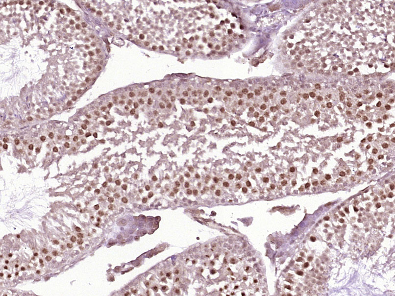 SGOL2 Rabbit pAb(bs-24137R)-50