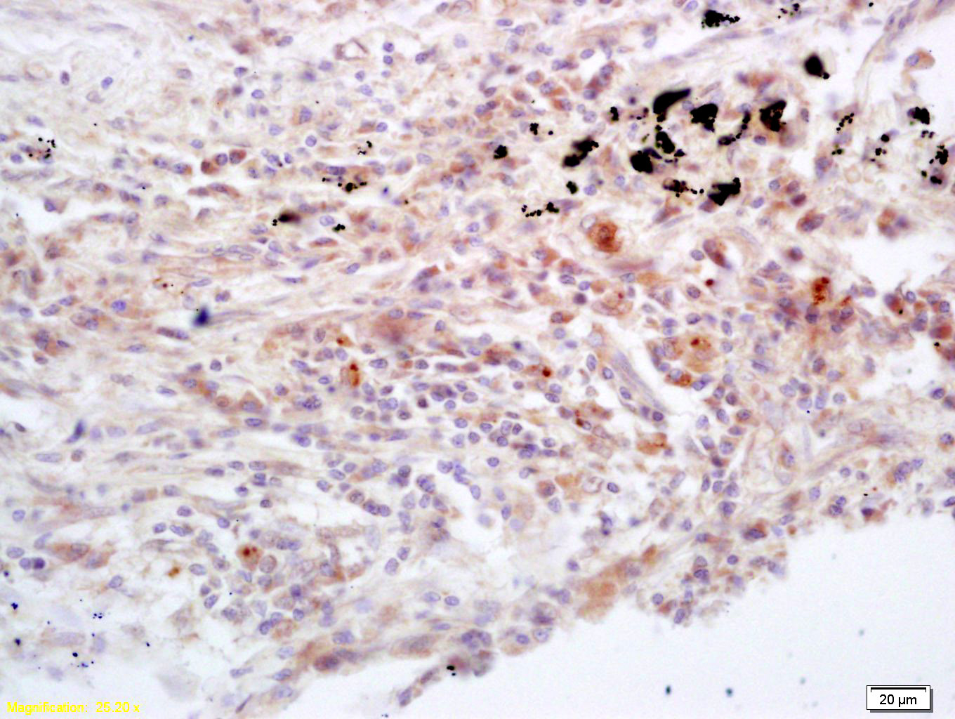 Jak3 Rabbit pAb(bs-2808R)-50ul
