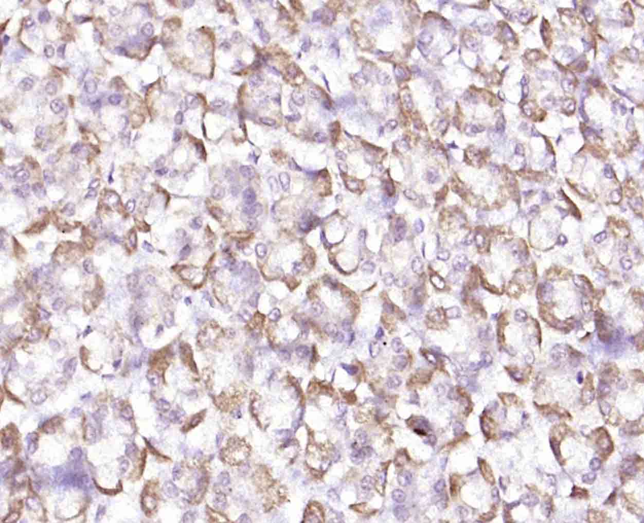 KATNA1 Rabbit pAb(bs-9308R)-50