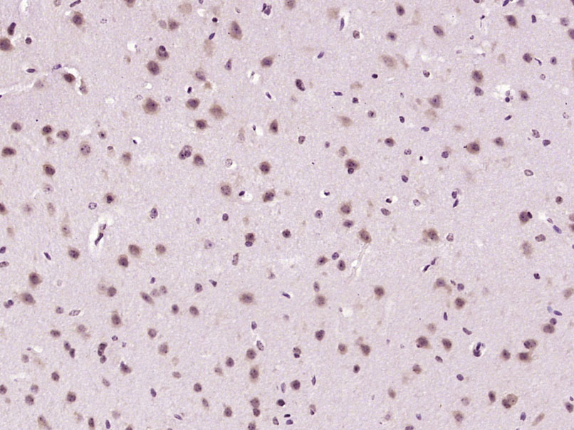 Ctip2 Rabbit pAb(bs-23677R)-50