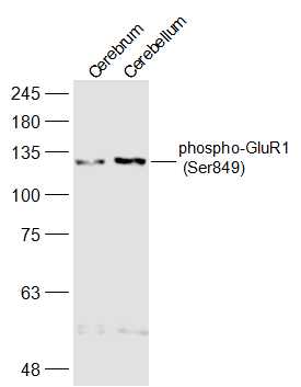 phospho-GluR1 (Ser849) Rabbit 