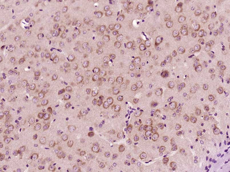 LCHN Rabbit pAb(bs-18187R)-50u