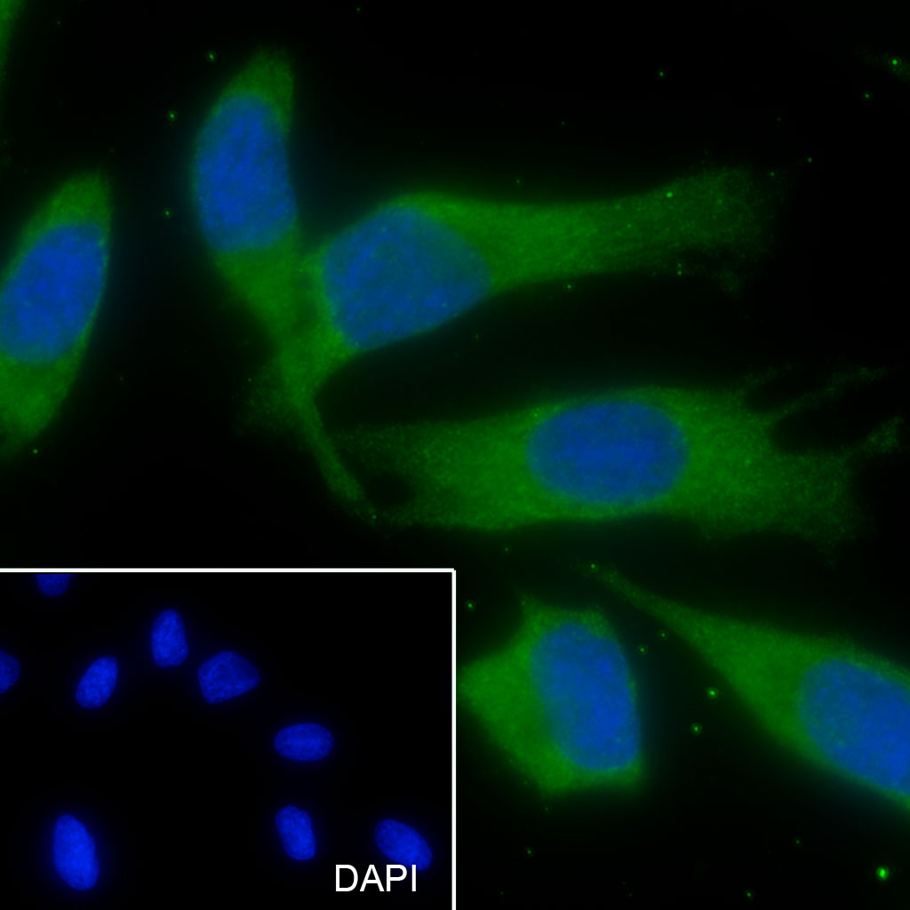 TMEM111 Recombinant Mouse mAb(