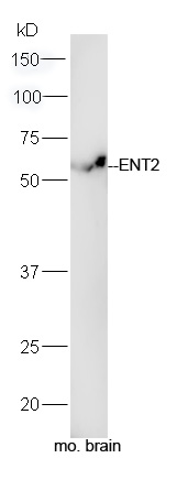 ENT2 Rabbit pAb(bs-10550R)-50u