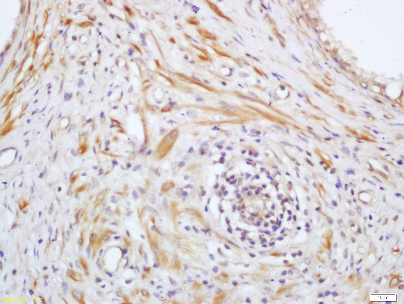 phospho-PAK4 (Ser99) Rabbit pA