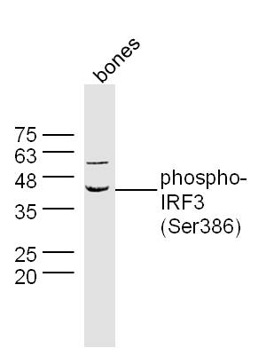 phospho-IRF3 (Ser386) Rabbit p