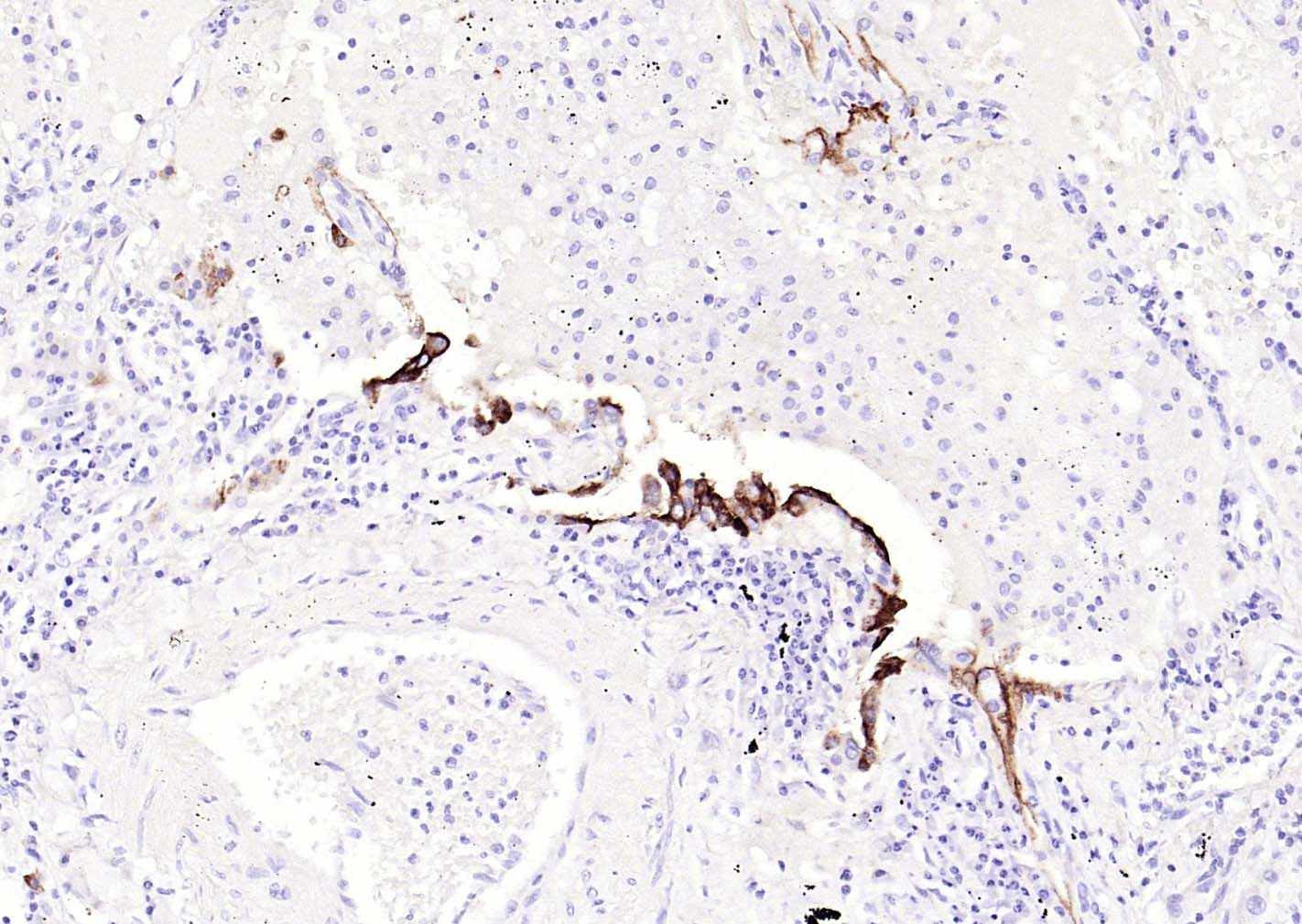 CEACAM5 Mouse mAb(bsm-43141M)-