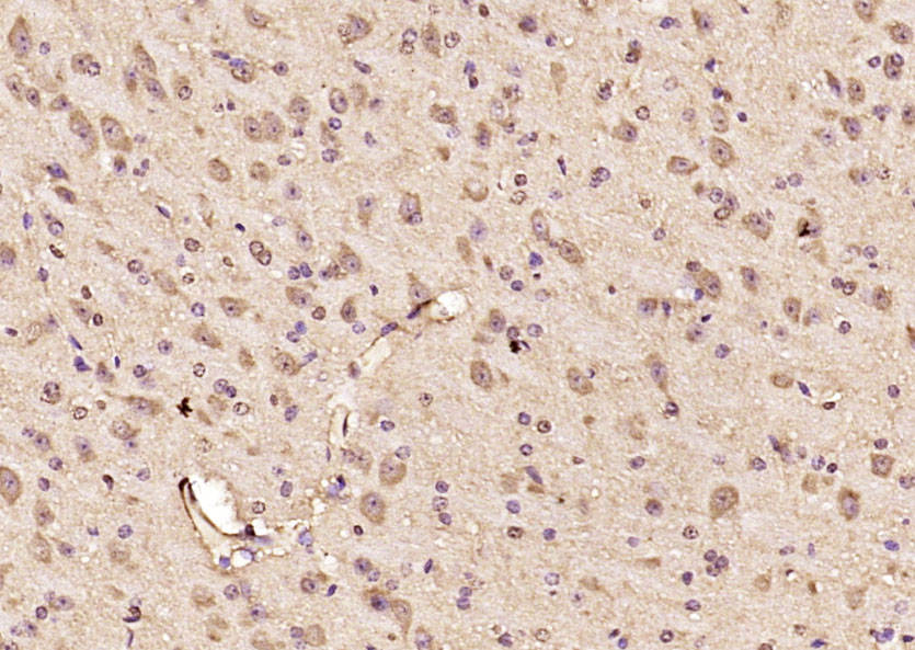 TRBP Rabbit pAb(bs-16709R)-50u