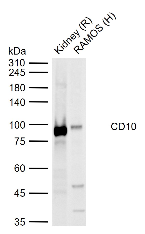 CD10 Rabbit pAb(bs-0527R)-50ul