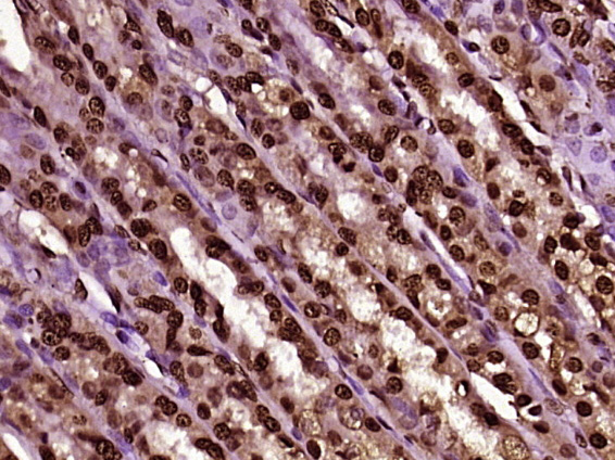 MPP6/MPHOSPH6 Rabbit pAb(bs-17